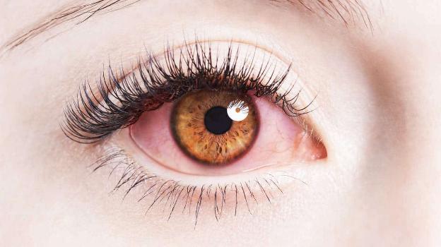 Các yếu tố gây ra viêm nhiễm bên trong mắt?
