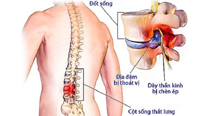 Giải phẫu cột sống và hệ thần kinh ngoại biên Y Học Cộng Đồng