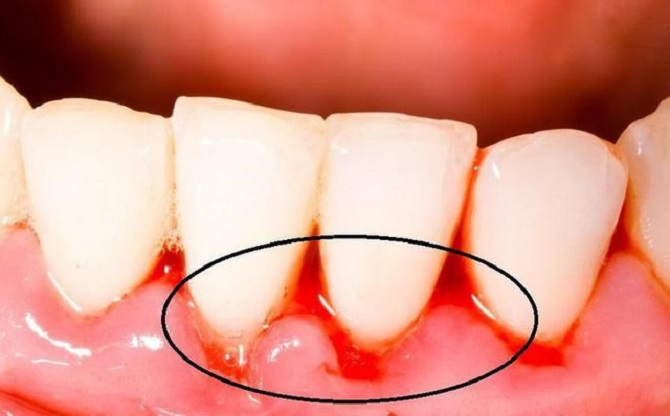 Chân răng là bộ phận nào trong hàm răng của con người?