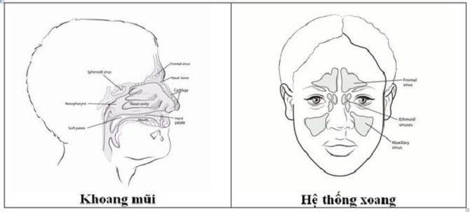 Những biến chứng có thể xảy ra nếu không điều trị viêm xoang mũi chảy máu?
