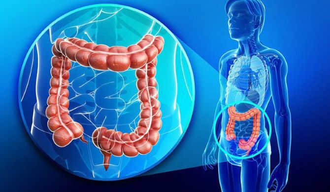 Tại sao chế độ ăn uống không khoa học có thể gây ra bệnh ung thư đại tràng? 
